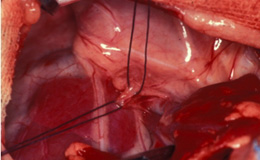 Thoraxchirurgie_1